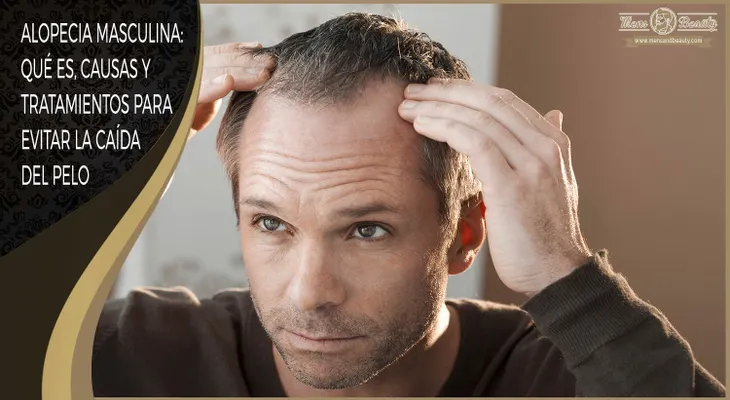 Tipos, Causas y Tratamientos para Evitar la Caída del Pelo