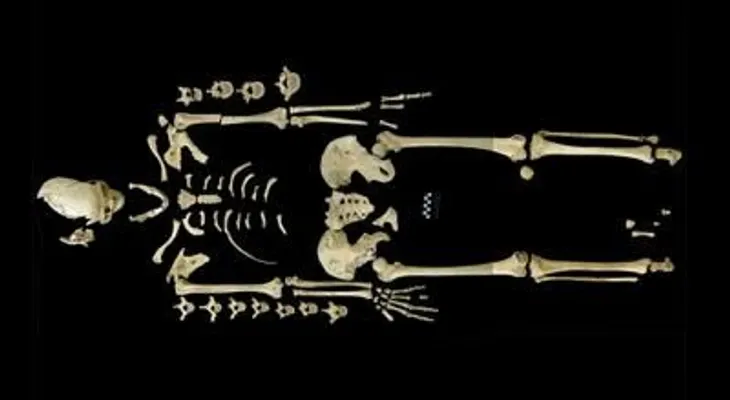 Primer caso de leucemia en un esqueleto de hace 7.000 años