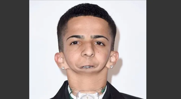 Joven sin mandíbula que escribe rap es nominado en premios para inspirar