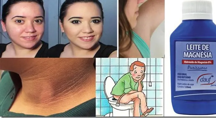 Los usos de la leche magnesia o "Magia Blanca" para la piel que necesitas conocer!