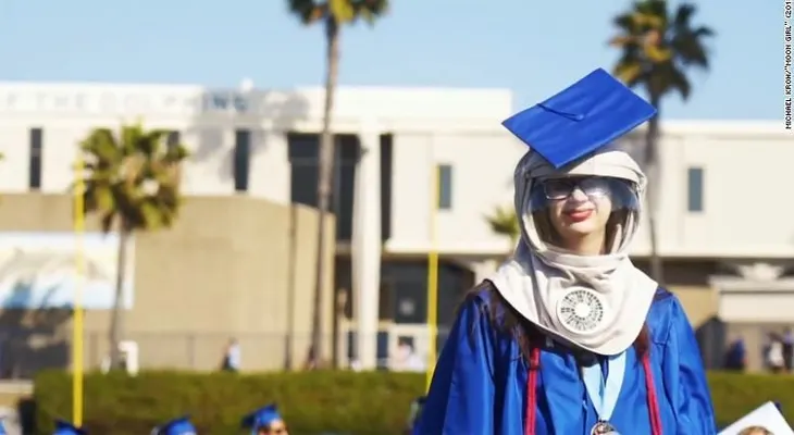 Tiene una enfermedad de la piel, pero desafió al sol para asistir a su graduación