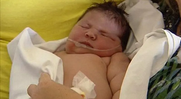 Nace bebe de 13 libras en España con parto natural