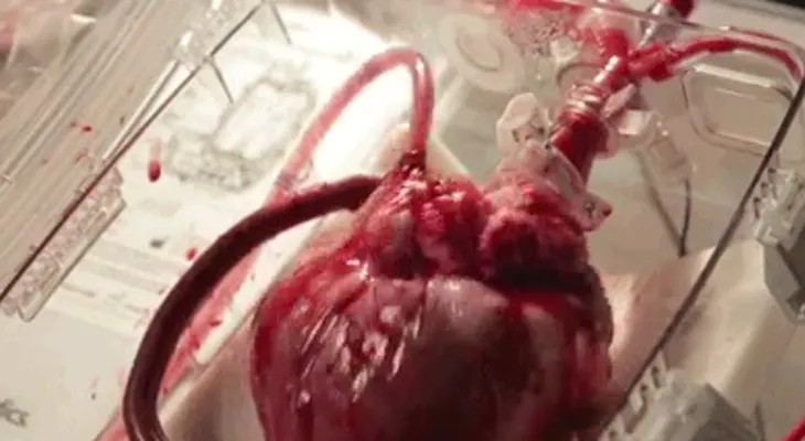 Descubren dispositivo revive corazones de personas que mueren