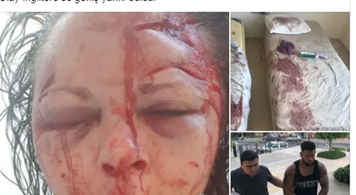 FUERTES IMAGENES: Un desconocido le da una golpiza a una turista porque se negó a tener sexo