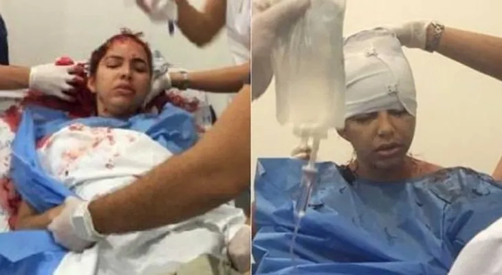 Su pareja le cortó el cuero cabelludo porque se negó a tener sexo