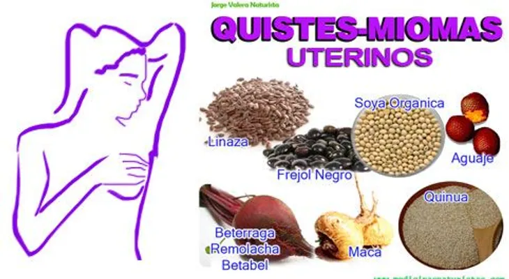 Remedios naturales para eliminar los miomas y quistes