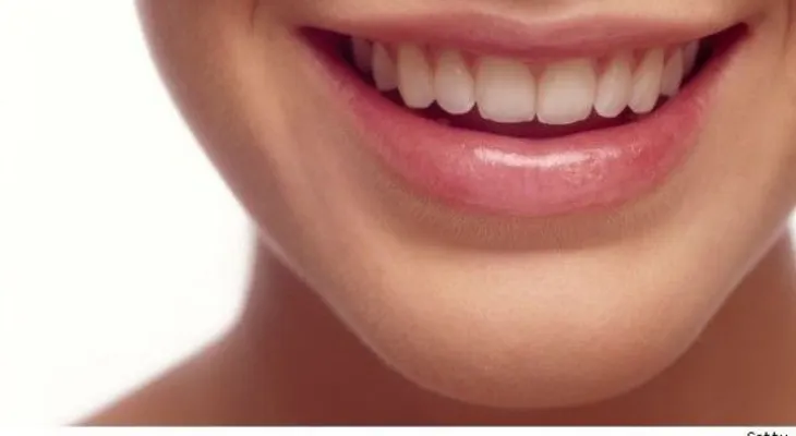 Periodontitis: El resultado de una mala higiene bucal