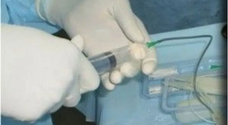 Dominicanos ya pueden hacerse implantes de pene