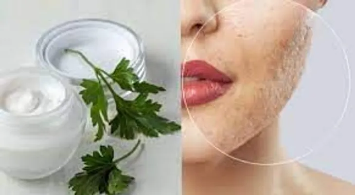 El perejil rejuvenece tu rostro, te diremos cómo se prepara