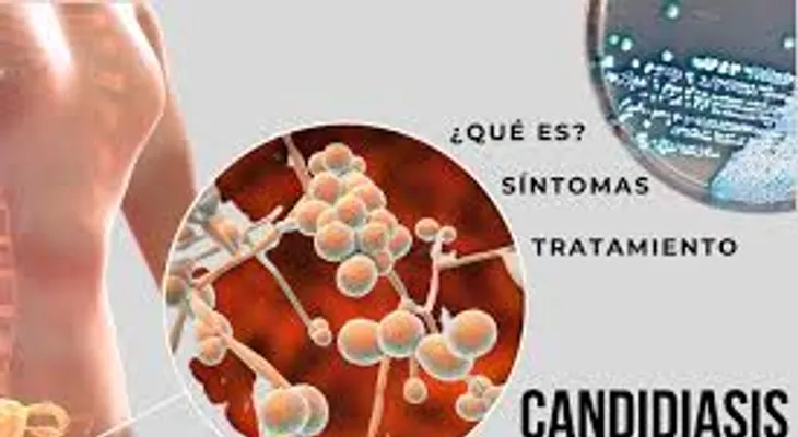 Aceites de coco y de orégano acaban los hongos vaginales
