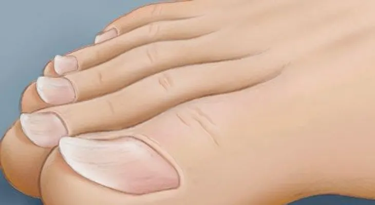 8 advertencias que tus uñas pueden estarte enviando 