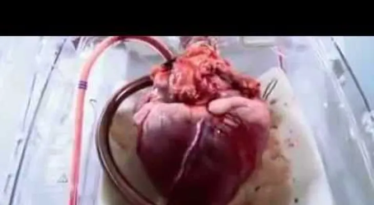 Un corazón latiendo en vivo y a todo color (VIDEO)