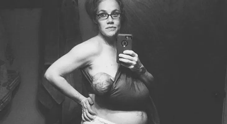 Foto posparto de mujer se hace viral