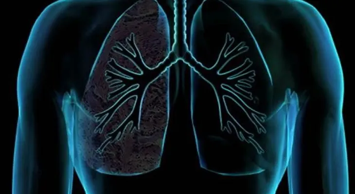 Como limpiar los pulmones en 3 días
