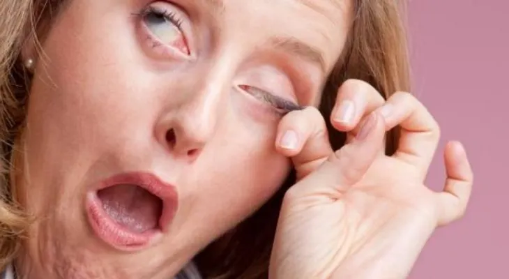 Si sufres de picazón frecuente en los ojos podrías tener alergia ocular