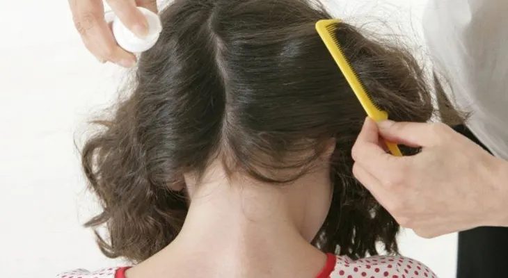 7 mitos falsos sobre los piojos que desconocías 