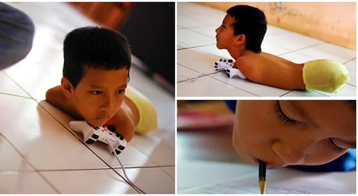 Este niño nació sin brazos ni piernas, pero tiene increíbles habilidades