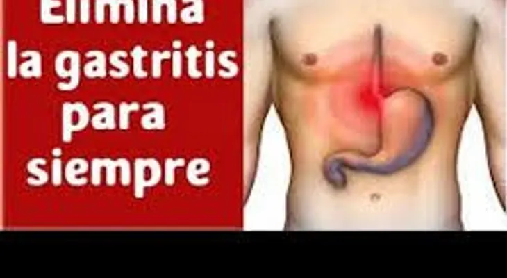 Eficaz remedio para eliminar la acidez y la gastriti para siempre