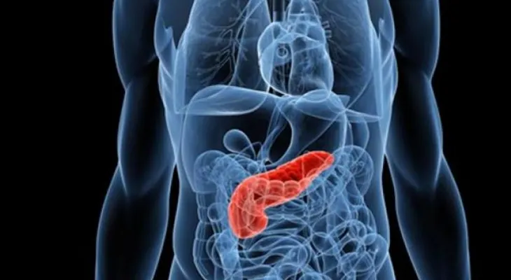 ¡Ojo! Los tumores neuroendocrinos no tienen síntomas específicos