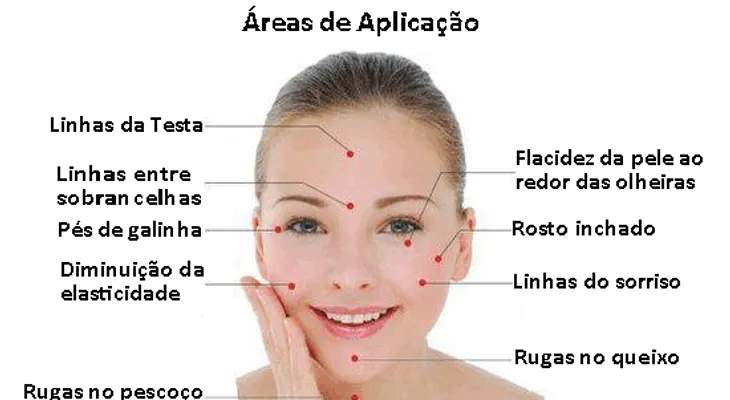 Acupuntura estética facial 