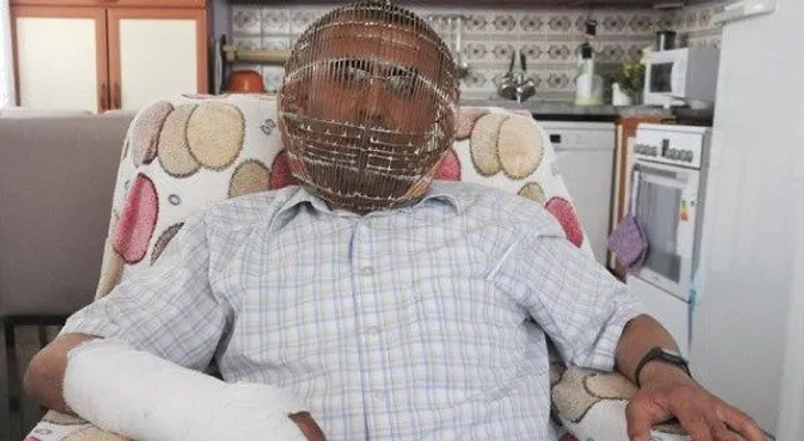 Se coloca una jaula para dejar de fumar