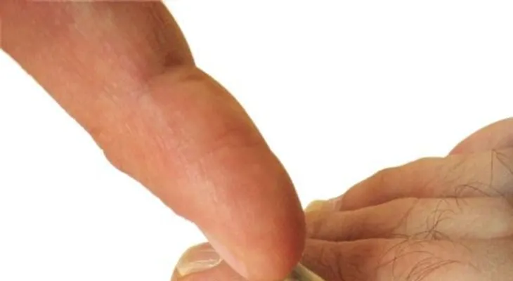 Remedios eliminan hongos uñas de los pies