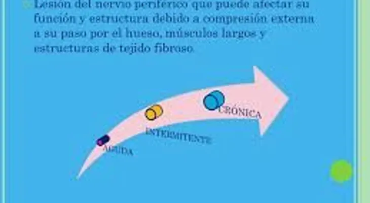 Síntomas de las neuropatías comprensivas