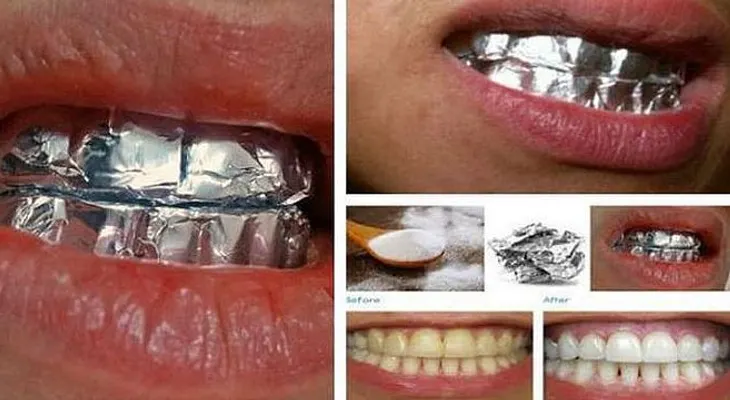 Fantástico remedio para quitar los dientes amarillentos 100% natural