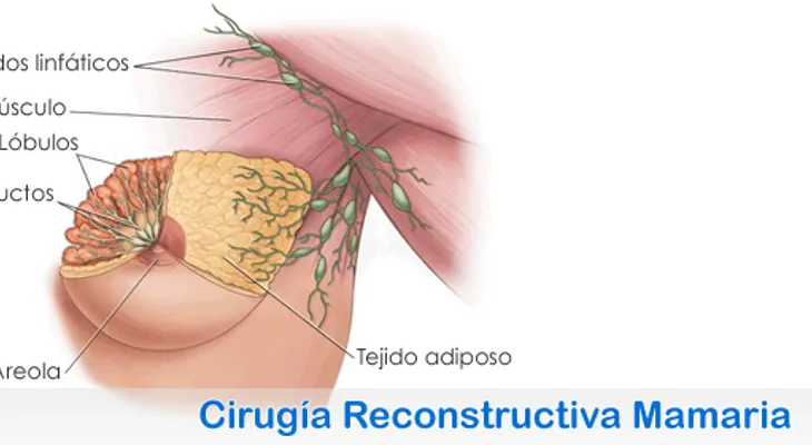 Cirugía estética de aumento de los senos