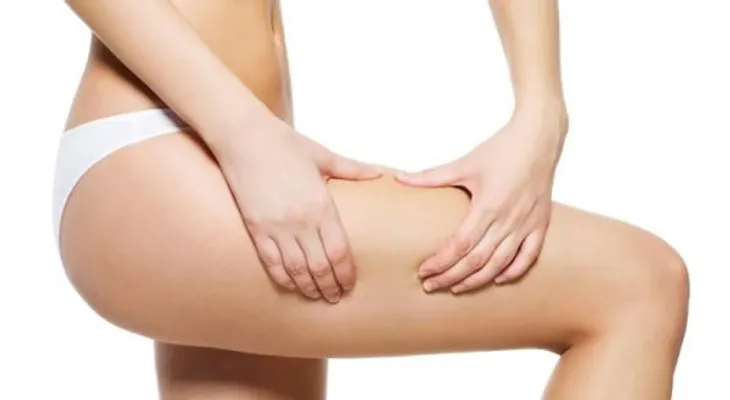 Cómo eliminar la celulitis de los muslos rápidamente
