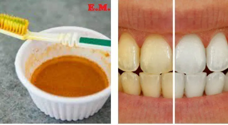 Cómo blanquear los dientes sin ir al dentista
