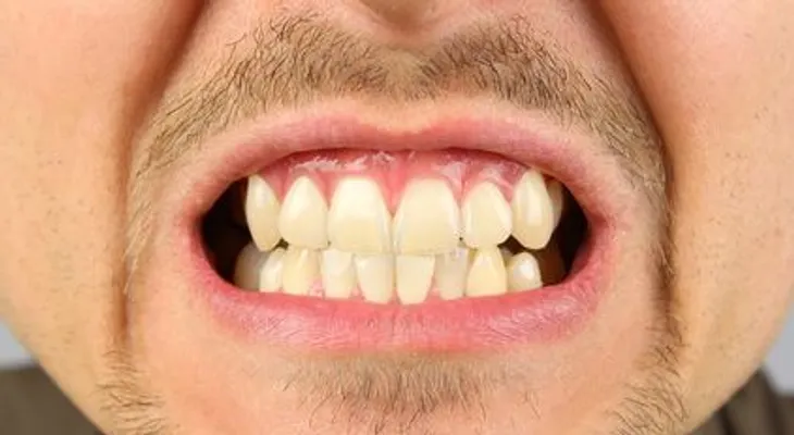¿A qué se debe el color de los dientes?