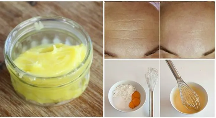 Eliminar las arrugas en 1 semana con esta poderosa crema natural