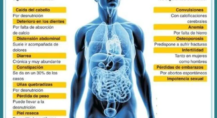 Claves para saber si eres celíaco