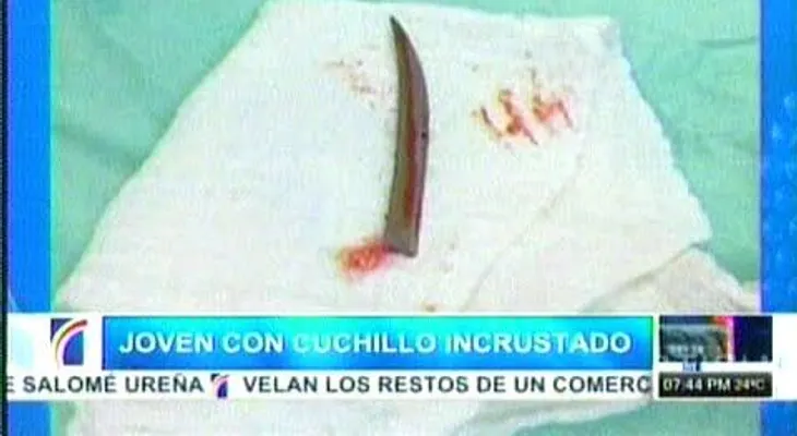 Joven va al médico por problemas respiratorios, y le encuentran un cuchillo en la espalda