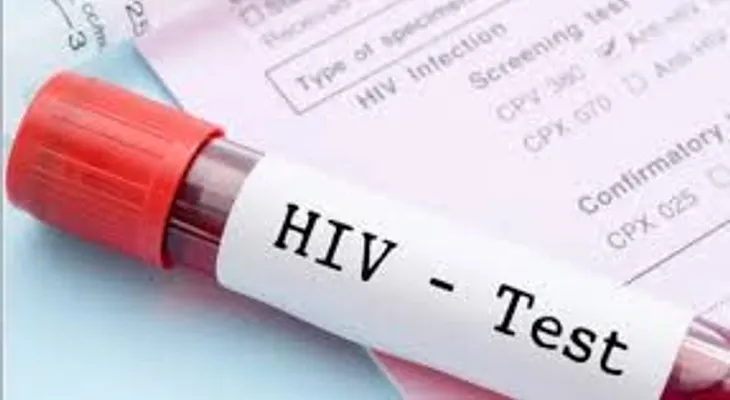 Se triplican casos de jóvenes mexicanos con VIH 