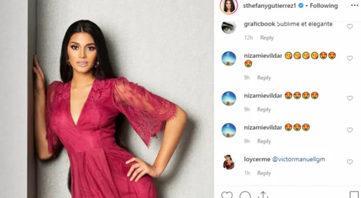 Así quedó Sthefany Gutiérrez luego de un "retoque estético"