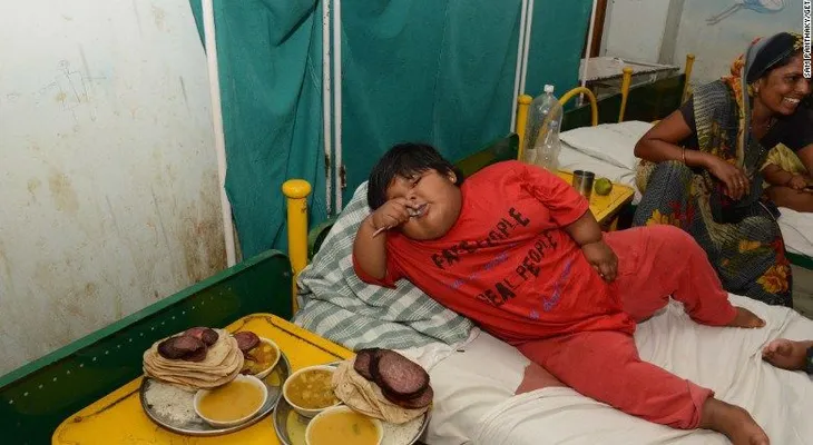 ¿Está la India demasiado obesa?