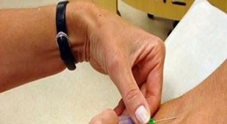 Curan mujer de leucemia inyectándole virus de sarampión modificado