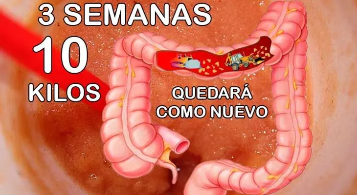 Descubre porqué esto te hace perder más de 10 kilos y limpia el colon rapidamente