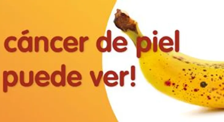 Cómo prevenir las manchas en la piel