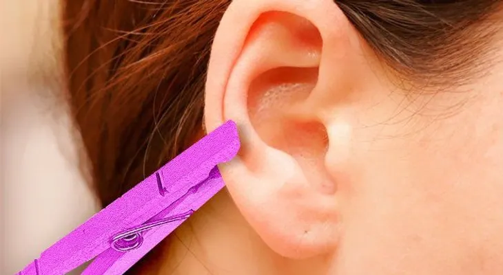 Aliviar el dolor rápido usando la oreja y una pinza de ropa