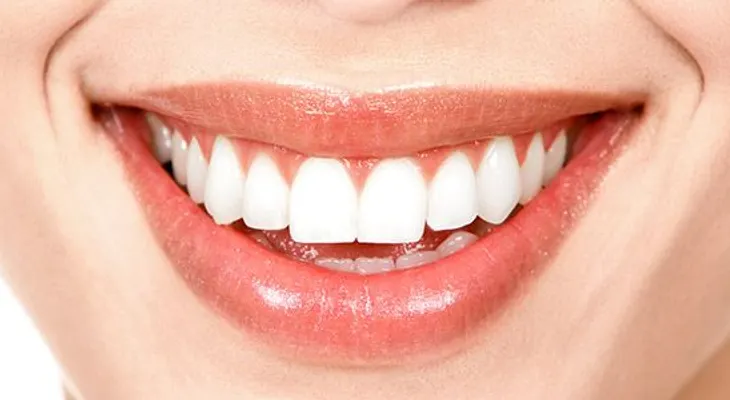 Perforaciones en la lengua pueden dañar tu boca 