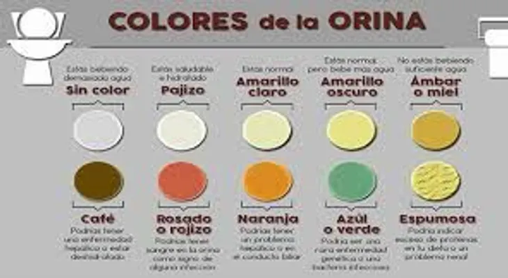 Chequea todo lo que debes conocer sobre el  color de tu orina para saber como anda tu salud