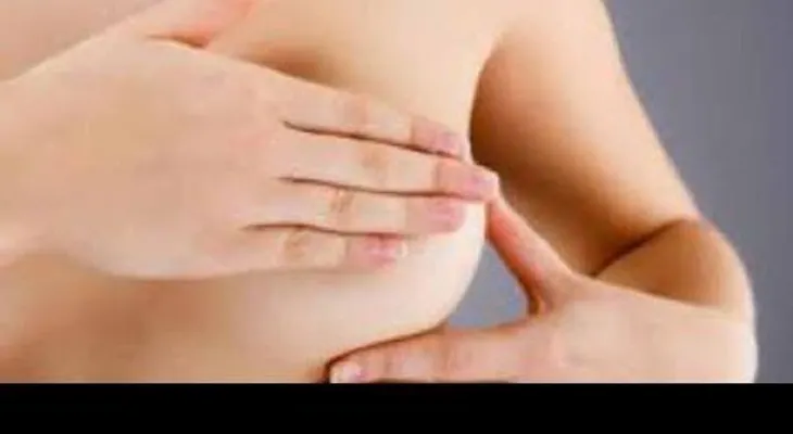 ¿Cuál es la causa de la galactorrea; afecta hombres y mujeres  (VIDEO)