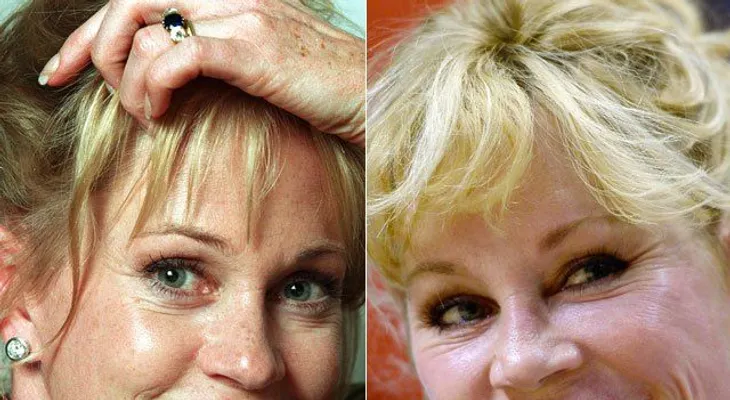 Melanie Griffith: las cirugías me estropearon el rostro: "Me veo más natural ahora