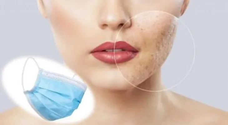 El uso prolongado de la mascarilla puedes causar irritaciones cutáneas, insuficiencia respiratorias y aumentar niveles de estrés
