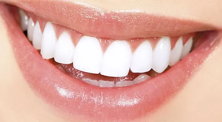 El arte de las sonrisas perfectas: Diseño de sonrisa