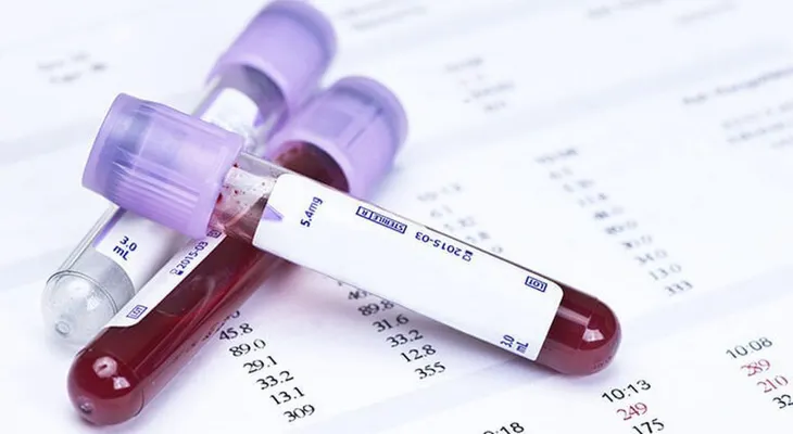 Un análisis de sangre detecta tumores 4 años antes que métodos convencionales