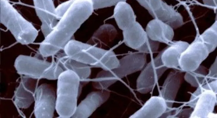  Ministerio de Salud alerta posible entrada desde Haití de fórmula láctea infantil con salmonella agona 